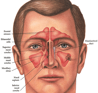 Sinus anatomy showing the maxillary sinus, ethmoid sinus, sphenoid sinus, and frontal sinus.