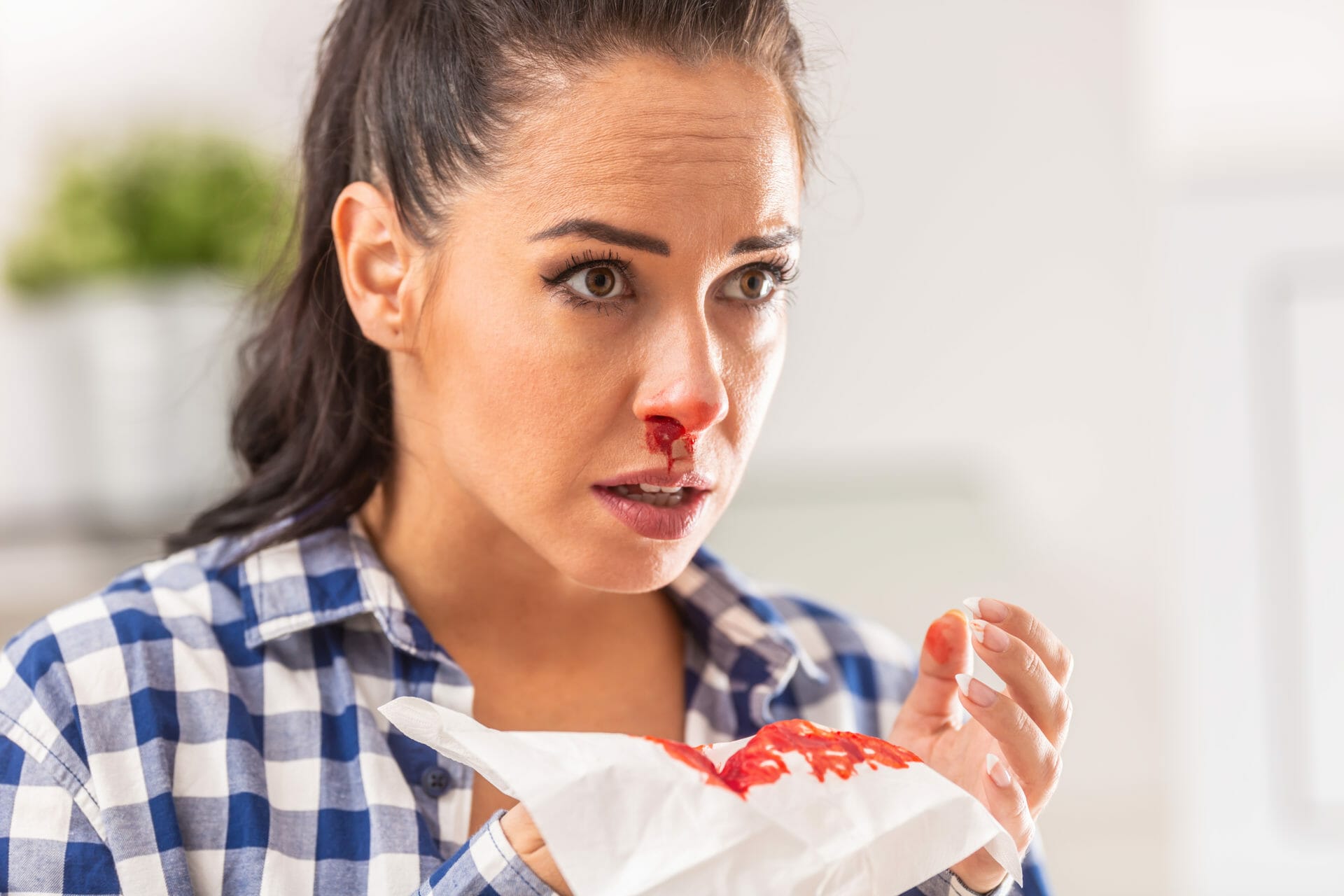 epistaxis-nosebleeds-sinushealth