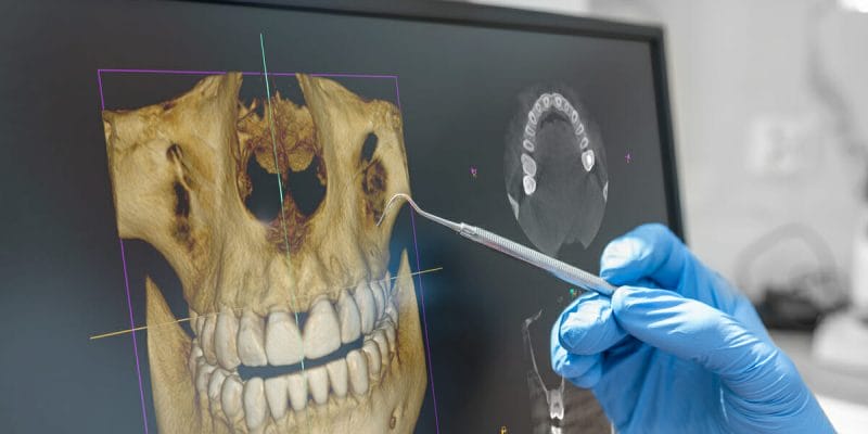 Doctor reviewing a CT scan of someone's teeth and face