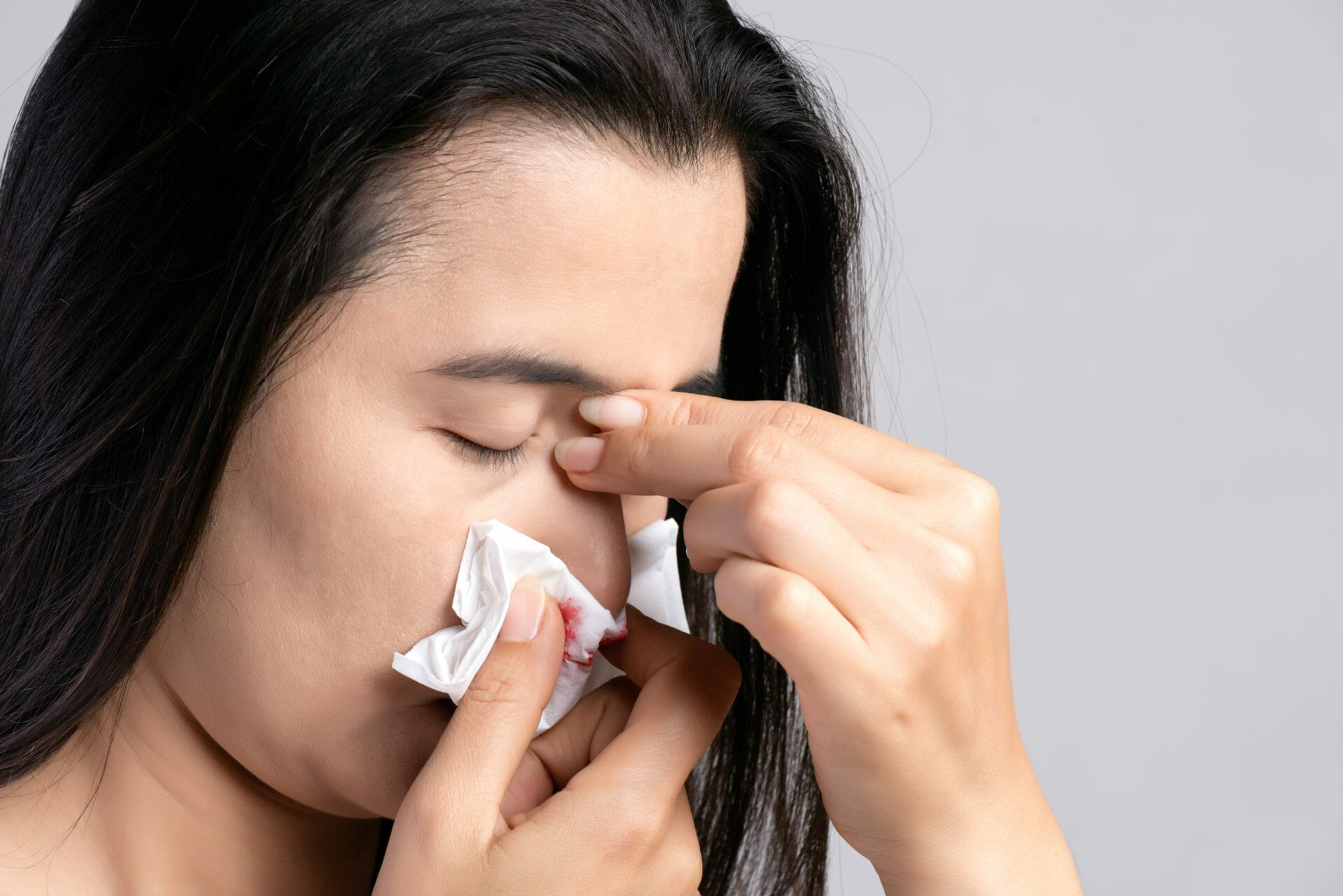 Epistaxis (Nosebleeds) - SinusHealth