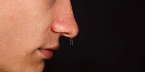 clear dripping from nose
