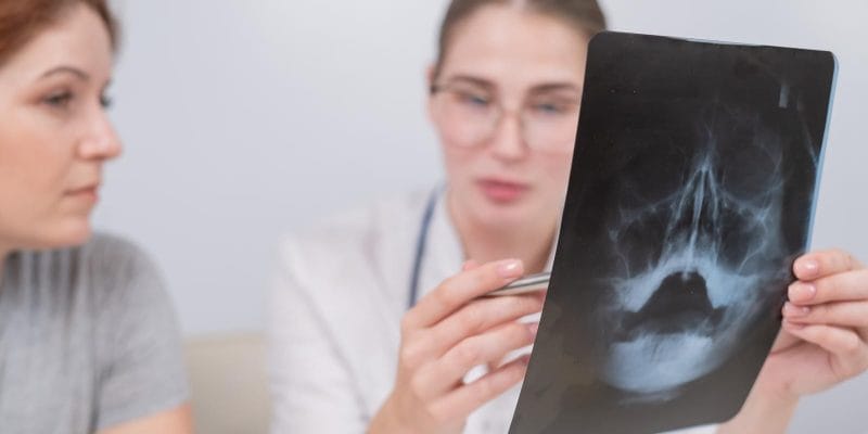Doctor reviewing sinus x-ray with patient